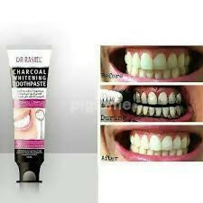 Dr Rashel Charcoal Whitening Toothpaste Whitening Complex