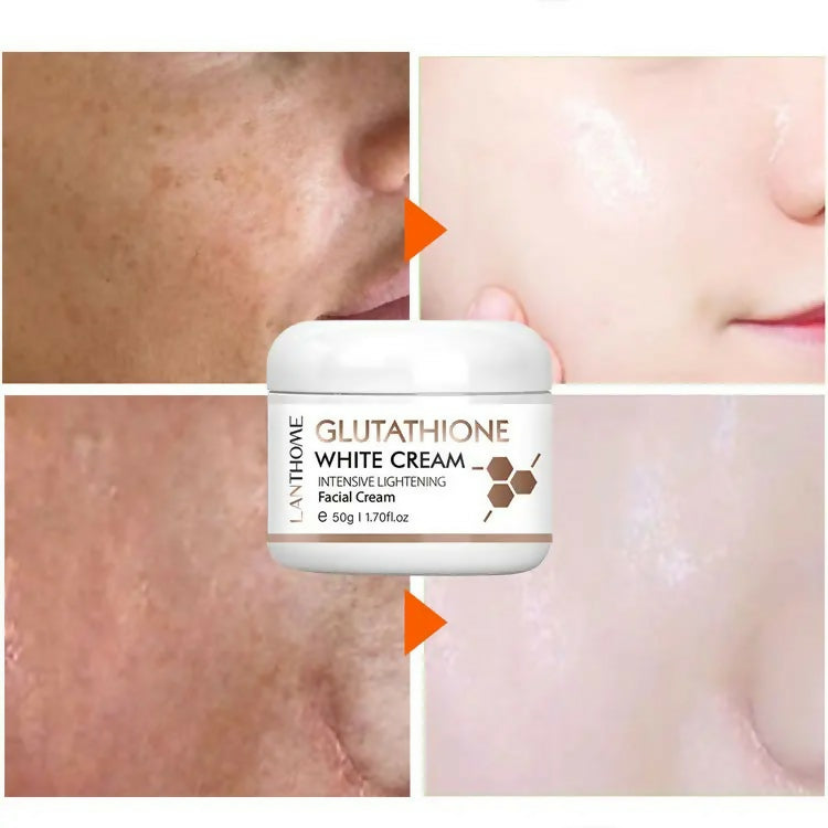 does glutathione help rosacea Dr. James Glutathione Cream: Radiant Skin & Anti-Aging Benefits