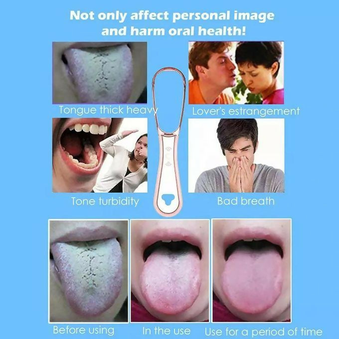 Tongue Scraper 100% BPA Free Effective Tongue Brush Tool Bad Breath Treatment Food Grade PP Tongue Cleaner For Oral Hygiene