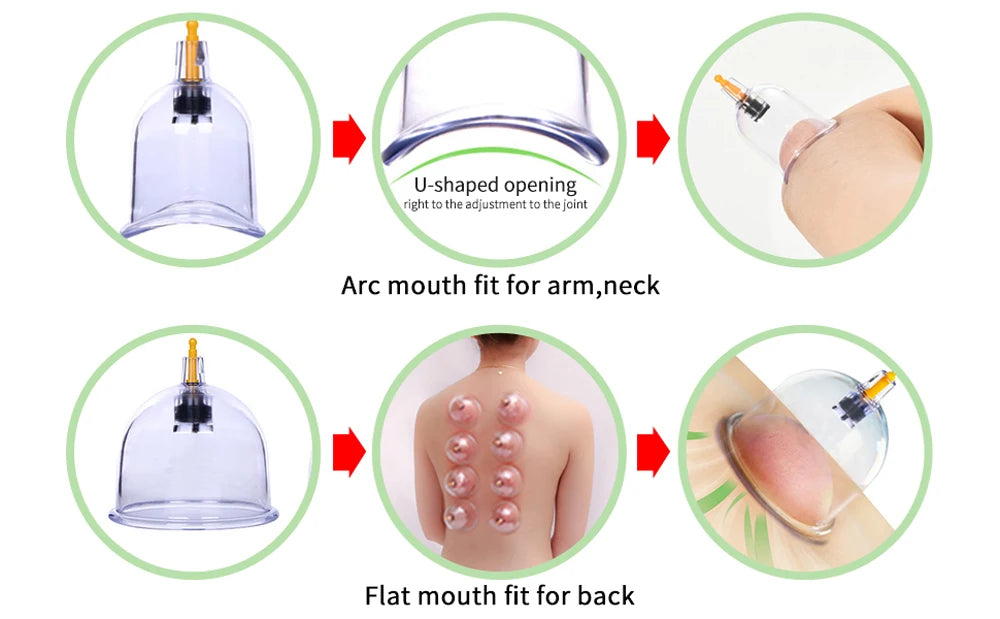 Cupping Therapy Sets,Hijama Cupping Vacuum Suction 24 Cups Sets for Cellulite Cupping Massage Back Pain Relief,Chinese Cupping