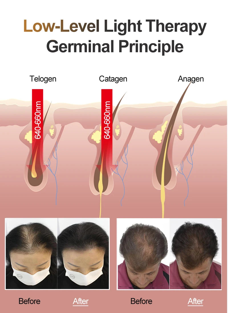 LESCOLTON Hair Growth Device Laser Hair Growth Helmet Laser Cap Hair Loss Treatment Hat for Mens and Women Wireless Rechargeable