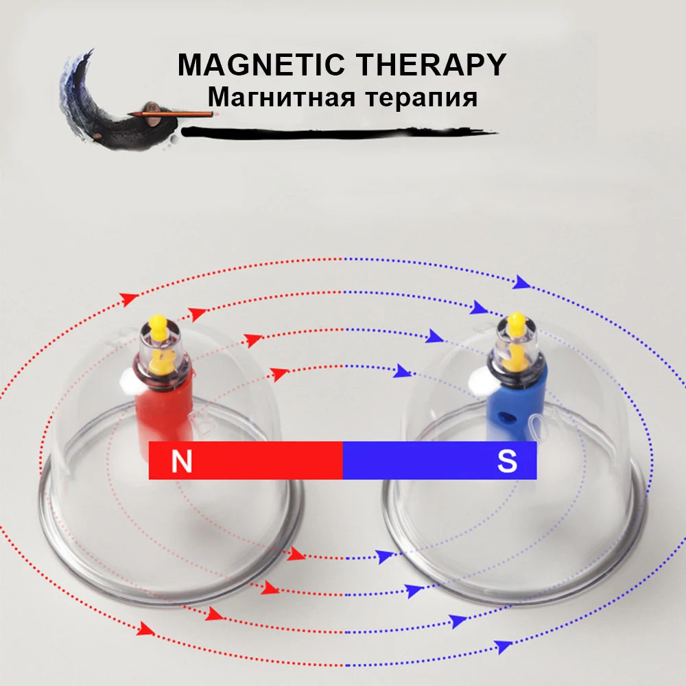 Cupping Massage Cups Therapy Sets Hijama Chinese Acupoint with Vacuum Pump for Body Back Massage Pain Relief Physical Therapy