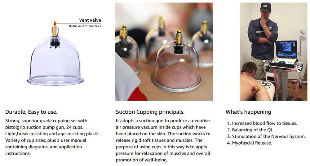 Cupping Therapy Sets,Hijama Cupping Vacuum Suction 24 Cups Sets for Cellulite Cupping Massage Back Pain Relief,Chinese Cupping