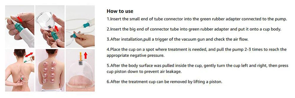 Cupping Therapy Sets,Hijama Cupping Vacuum Suction 24 Cups Sets for Cellulite Cupping Massage Back Pain Relief,Chinese Cupping
