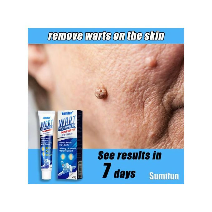 Warts Remover Ointment – Fast & Natural Treatment for Warts, Moles, Skin Tags & Corns