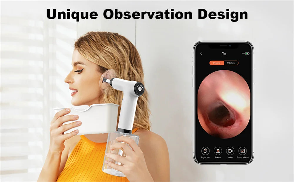 Electric Ear Wax Removal Kit with Soft Spray Safe and Effective Ear Cleaner with 4 Pressure Settings for Ear Wax Irrigation Tool