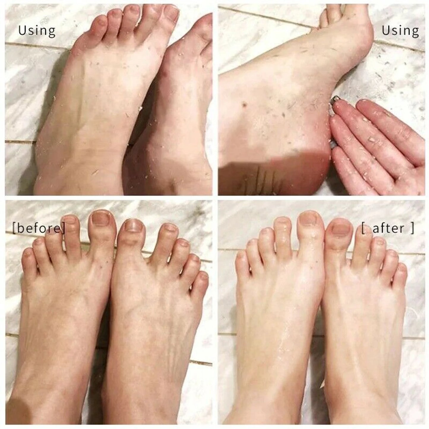 110ML Foot Peeling Spray Improve Rough Skin Available For Whole Body