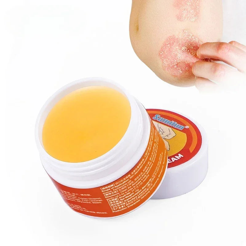 Medical Psoriasis Cream Dermatitis Eczematoid Ointment Antibacterial Anti Itching Rash Urticaria Plaster Skin Care Cream