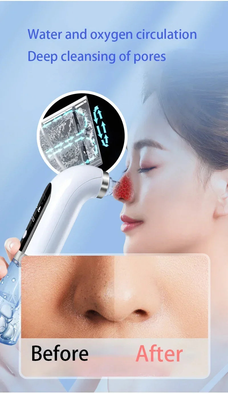 Blackhead Remover Pore Vacuum Face Cleaner Electric Pimple Black Head Removal USB Rechargeable Water Cycle Facial Cleaning Tools