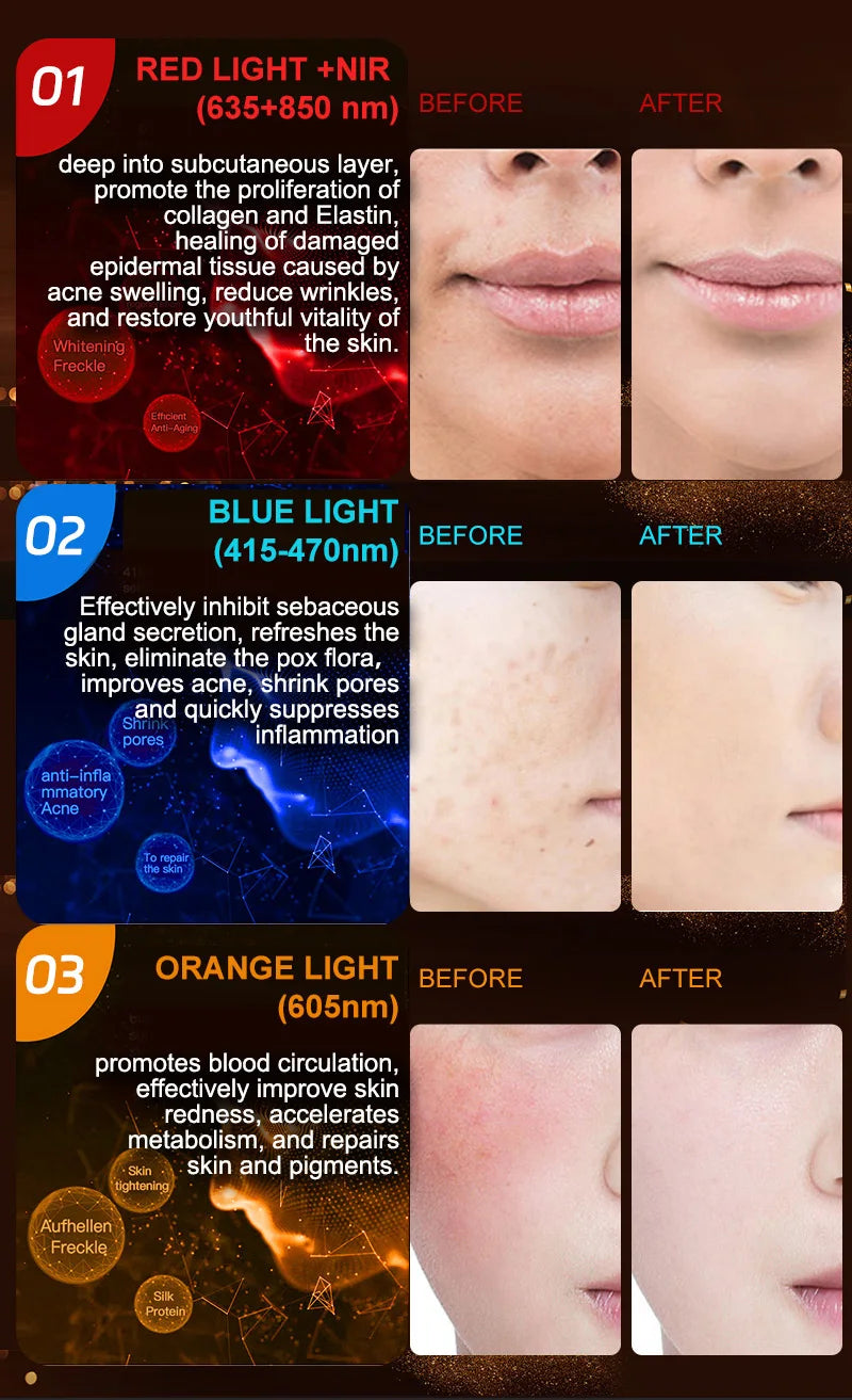 NIR LED Face Mask Neck Mask 92 and 78 Lamp 368 and 312 Beam Infrared Light Therapy 3 Brightness Reduce Wrinkle Acne Facial Care