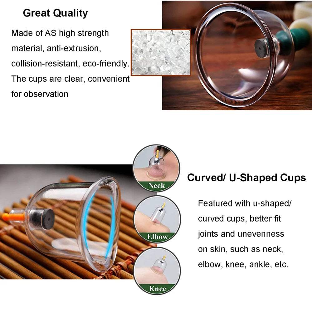 Cupping Therapy Sets,Hijama Cupping Vacuum Suction 24 Cups Sets for Cellulite Cupping Massage Back Pain Relief,Chinese Cupping