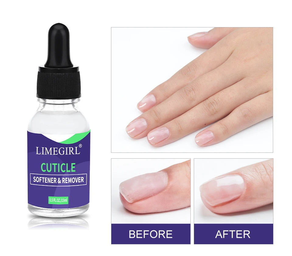 LIMEGIRL 15ml Nail Care Cuticle Regenerating Oil Preventative Nail Polish Softener for Dead Skin Gel Manicure Care Tool