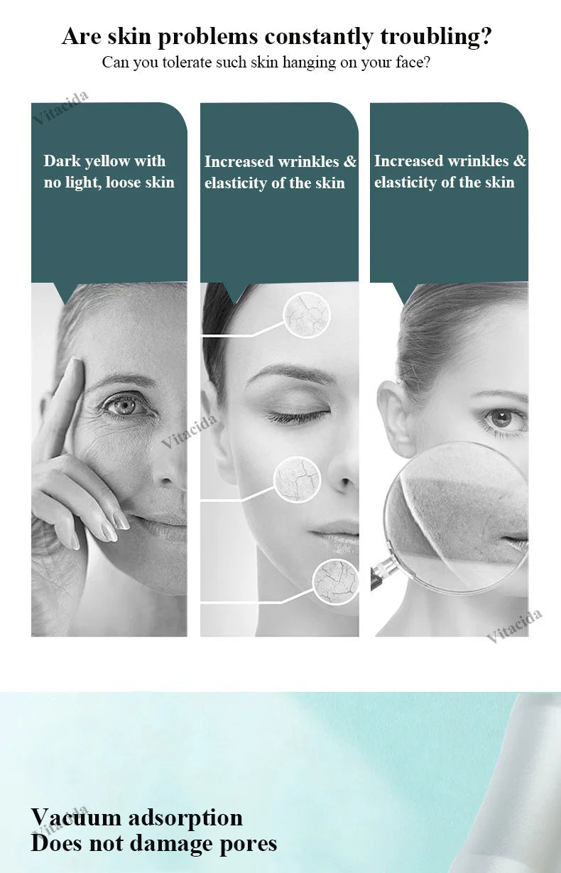 2024 Beauty Facial Lift Cleaner Pore Vacuum Blackhead Remover Portable Deep Cleansing Small Bubble Hydro Machine for Nose Face
