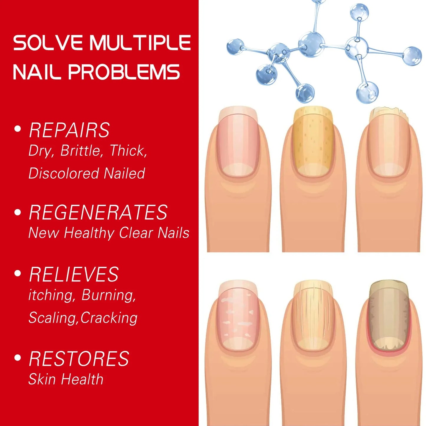 1/2/5pcs Nail Care Essence-Liquid Repairing Yellowing And Thickening Gray Nails Of Hands And Feet Nail Moisturizing Liquid 20ml