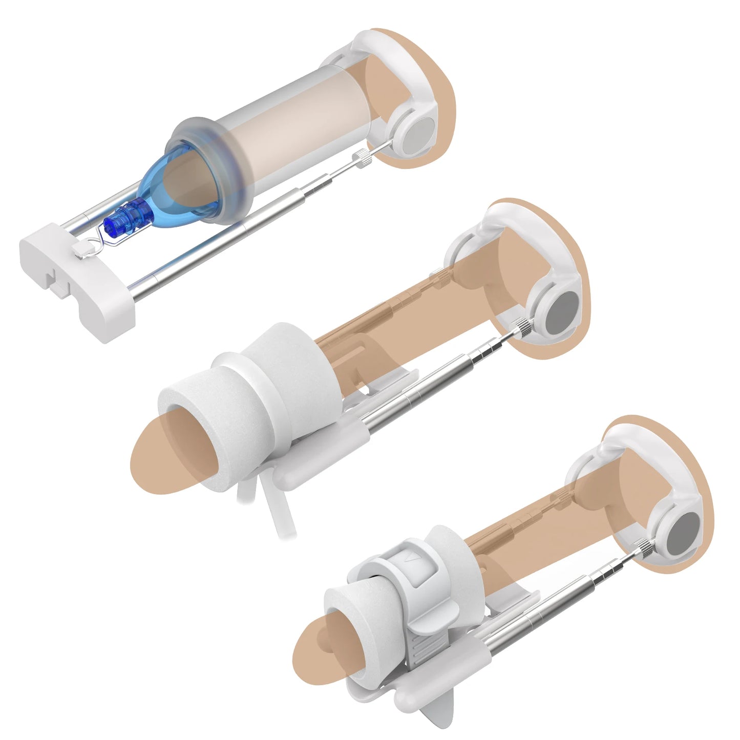 New Size Master Pro for Male Penis Enlargement Best Penis Growth Device Penis Master Extender with Phallosan Vacuum cup