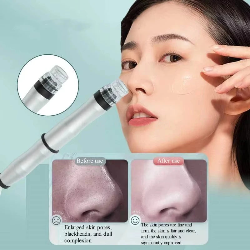 2024 Beauty Facial Lift Cleaner Pore Vacuum Blackhead Remover Portable Deep Cleansing Small Bubble Hydro Machine for Nose Face