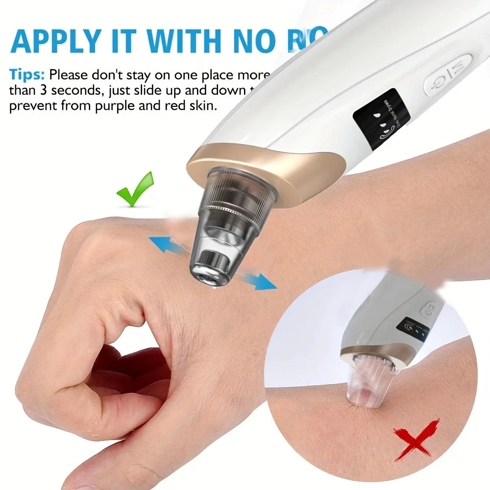 Blackhead Remover Pore Vacuum - 5 Suction - USB Rejected Facial Pore Cleaner Kit For Adult Acne Extractor Tool