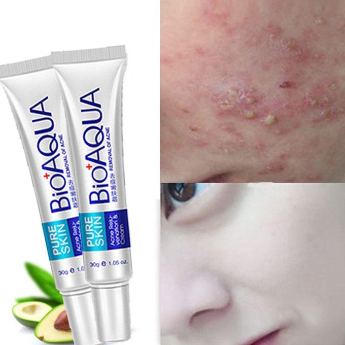 Face Skin Care Acne Cream Spots Scar Blemish Marks Removal - 30g