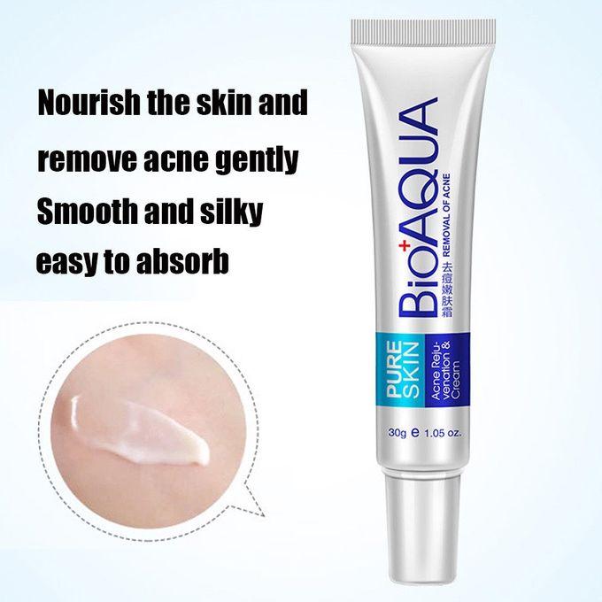Face Skin Care Acne Cream Spots Scar Blemish Marks Removal - 30g