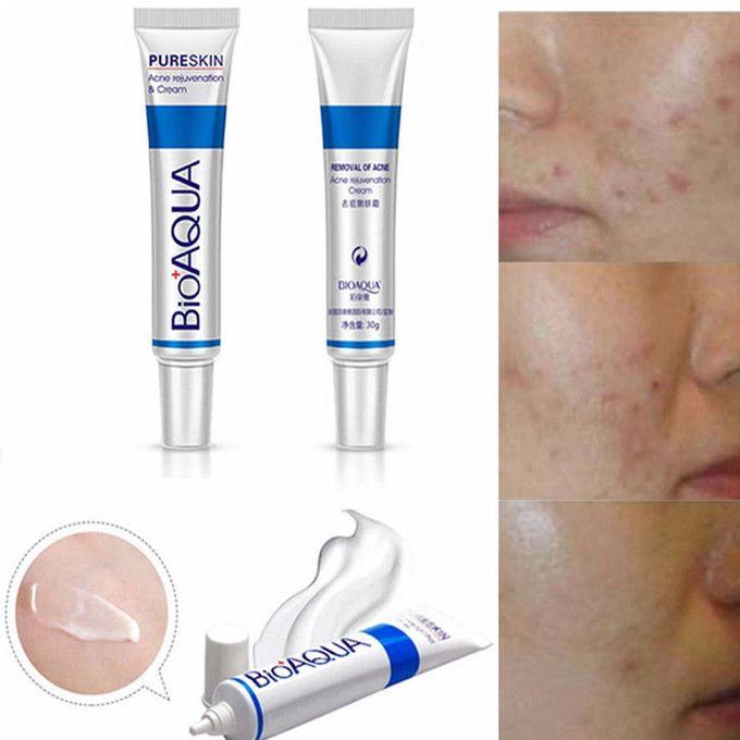 Face Skin Care Acne Cream Spots Scar Blemish Marks Removal - 30g