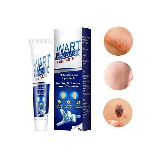 Warts Remover Ointment – Fast & Natural Treatment for Warts, Moles, Skin Tags & Corns