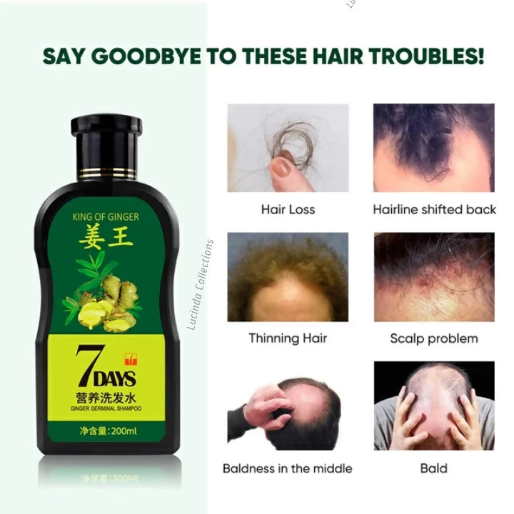 Oil + Shampoo - King Of Ginger 7 Days Ginger Germinal Hair Growth