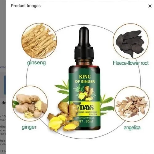 Aichun Beauty Ginger Hair Growth Oil – 7 Days Rapid Growth Essence for Bald Spots, Edges & Thinning Hair (30ml)