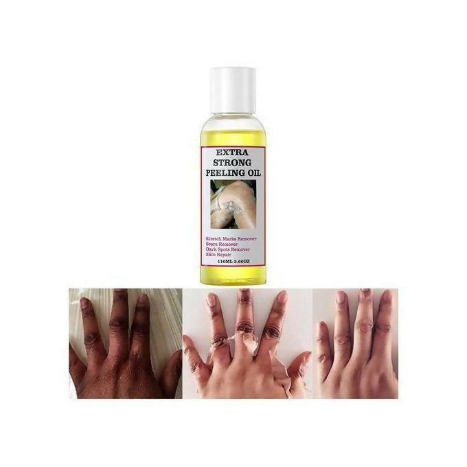 Extra Strong Yellow Peeling Oil