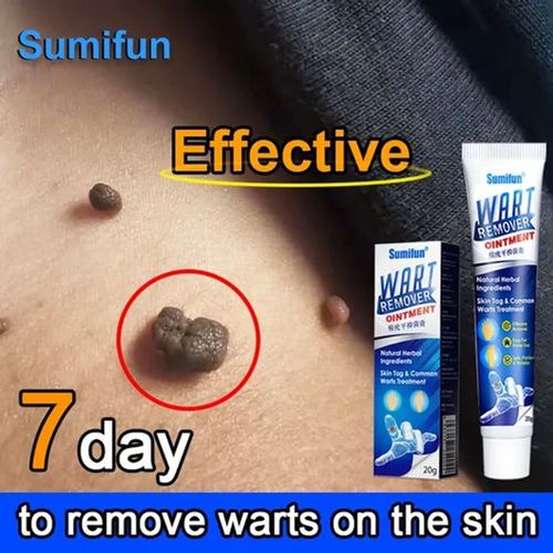 Warts Remover Ointment – Fast & Natural Treatment for Warts, Moles, Skin Tags & Corns
