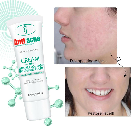 Aichun Beauty Anti-Acne Cleaning Cream