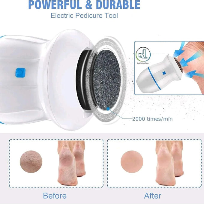 Rechargeable Find Back Callus Remover With Built-In Vacuum Foot Grinder Machine Hard Crack Cleaning