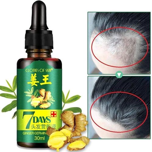 Aichun 7 Days Hair Growth Oil – Ginger & Herbal Tonic for Hair Regrowth & Anti-Hair Loss