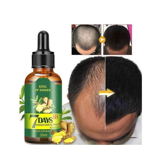 Aichun 7 Days Hair Growth Oil – Ginger & Herbal Tonic for Hair Regrowth & Anti-Hair Loss