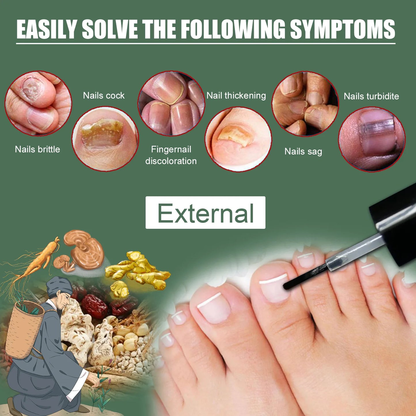 Nail Fungus Removal Serum Remove Onychomycosis Thickened Nail Repair Anti Infection Stop Pain Paronychia Treatment Essential Oil