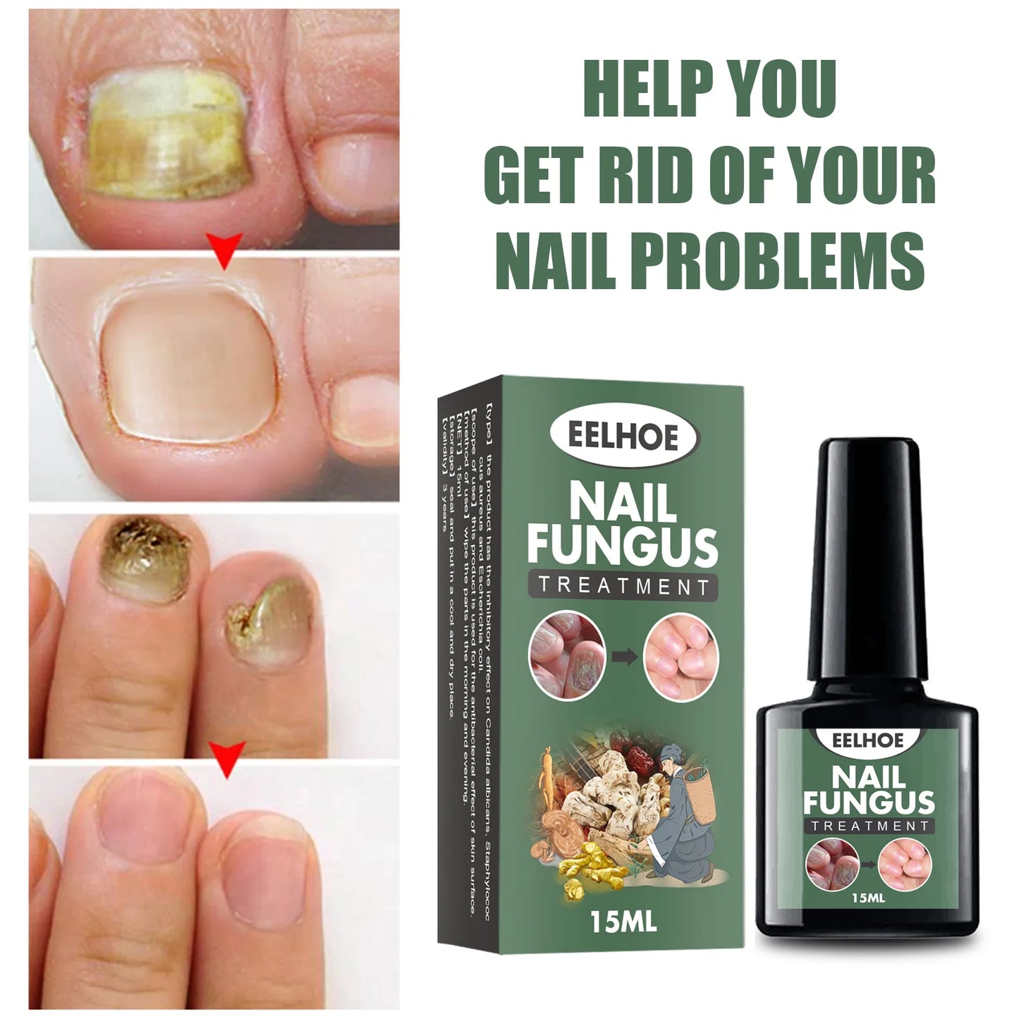 Nail Fungus Removal Serum Remove Onychomycosis Thickened Nail Repair Anti Infection Stop Pain Paronychia Treatment Essential Oil