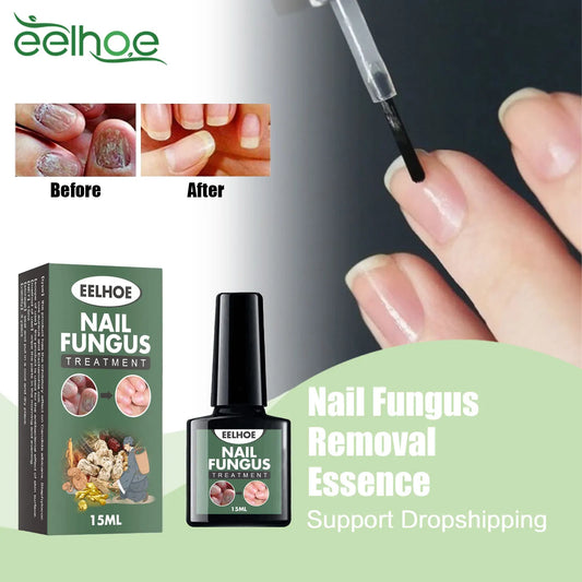 Nail Fungus Removal Serum Remove Onychomycosis Thickened Nail Repair Anti Infection Stop Pain Paronychia Treatment Essential Oil