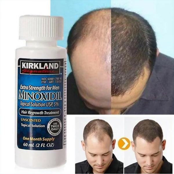 Minoxidil 5% Hair Regrowth Treatment For Men