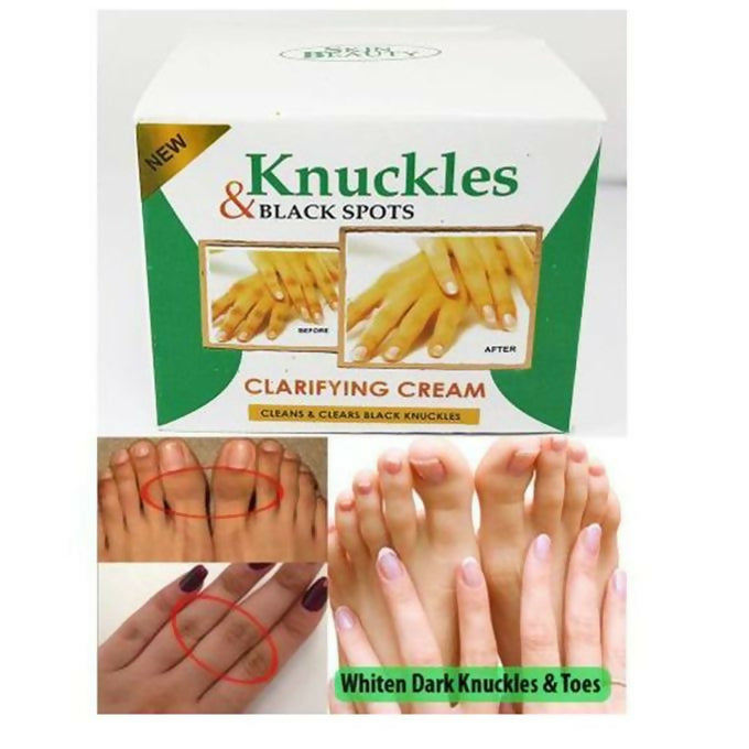 Skin Beauty Knuckles Elbow Knee Toes Black Spot Cream