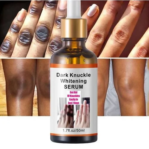 Dark Spots Corrector Serum for Elbows, Knuckles, Knees & Underarms – Skin Brightening & Even Tone Treatment (30ml)