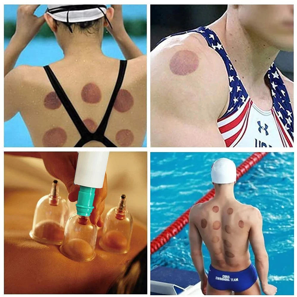 24/32 Therapy Cups Cupping Therapy Set with Pump, Professional Chinese Acupoint Cupping Therapy Hijama for Massage Muscle&Joints