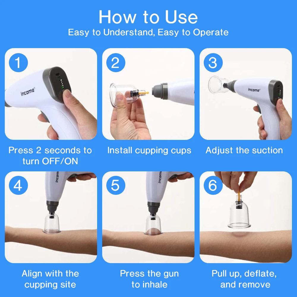 Suction Cups Anti Cellulite Electric Bank Vacuum Hijama Cupping Glasses Therapy Chinese Medicine Physiotherapy Massage Body Jars