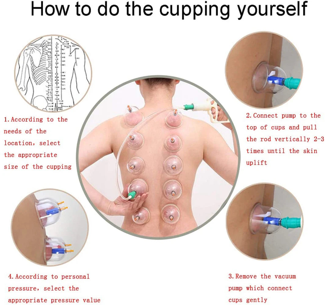 Cupping Massage Cups Therapy Sets Hijama Chinese Acupoint with Vacuum Pump for Body Back Massage Pain Relief Physical Therapy