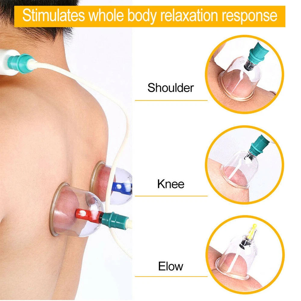 Cupping Massage Cups Therapy Sets Hijama Chinese Acupoint with Vacuum Pump for Body Back Massage Pain Relief Physical Therapy