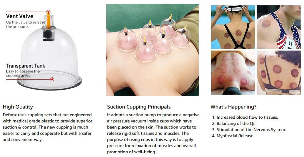 24/32 Therapy Cups Cupping Therapy Set with Pump, Professional Chinese Acupoint Cupping Therapy Hijama for Massage Muscle&Joints