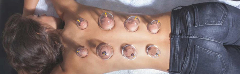 24/32 Therapy Cups Cupping Therapy Set with Pump, Professional Chinese Acupoint Cupping Therapy Hijama for Massage Muscle&Joints