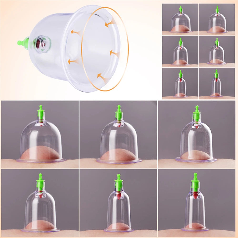 Cupping Massage Cups Therapy Sets Hijama Chinese Acupoint with Vacuum Pump for Body Back Massage Pain Relief Physical Therapy