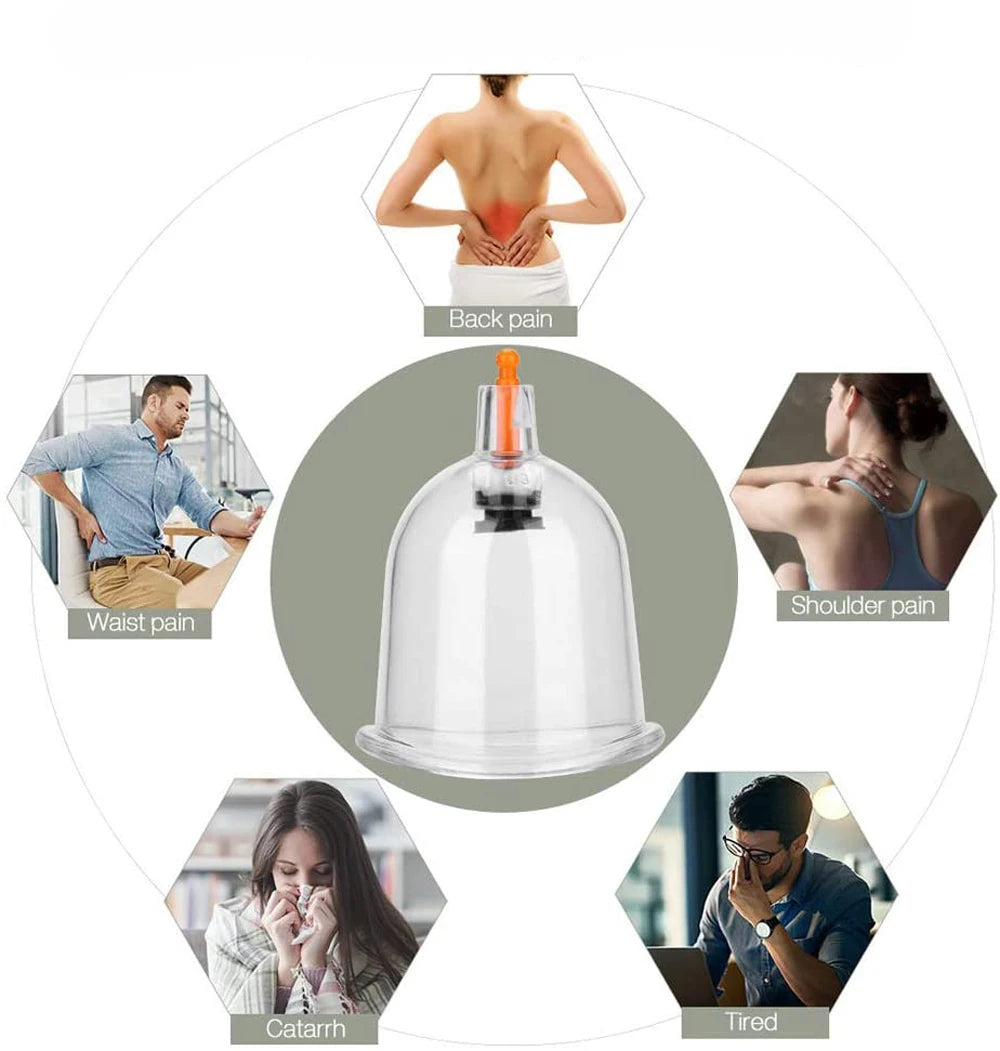 Cupping Massage Cups Therapy Sets Hijama Chinese Acupoint with Vacuum Pump for Body Back Massage Pain Relief Physical Therapy