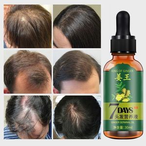 Aichun 7 Days Hair Growth Oil – Ginger & Herbal Tonic for Hair Regrowth & Anti-Hair Loss