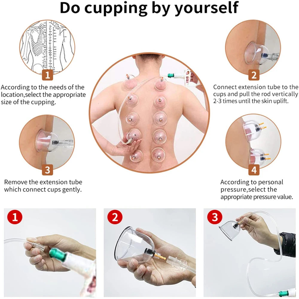 24/32 Therapy Cups Cupping Therapy Set with Pump, Professional Chinese Acupoint Cupping Therapy Hijama for Massage Muscle&Joints