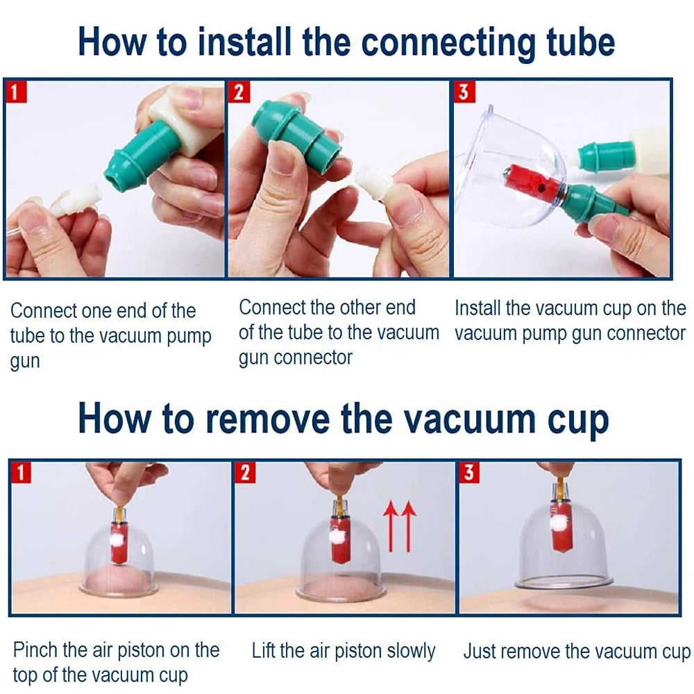 24/32 Therapy Cups Cupping Therapy Set with Pump, Professional Chinese Acupoint Cupping Therapy Hijama for Massage Muscle&Joints